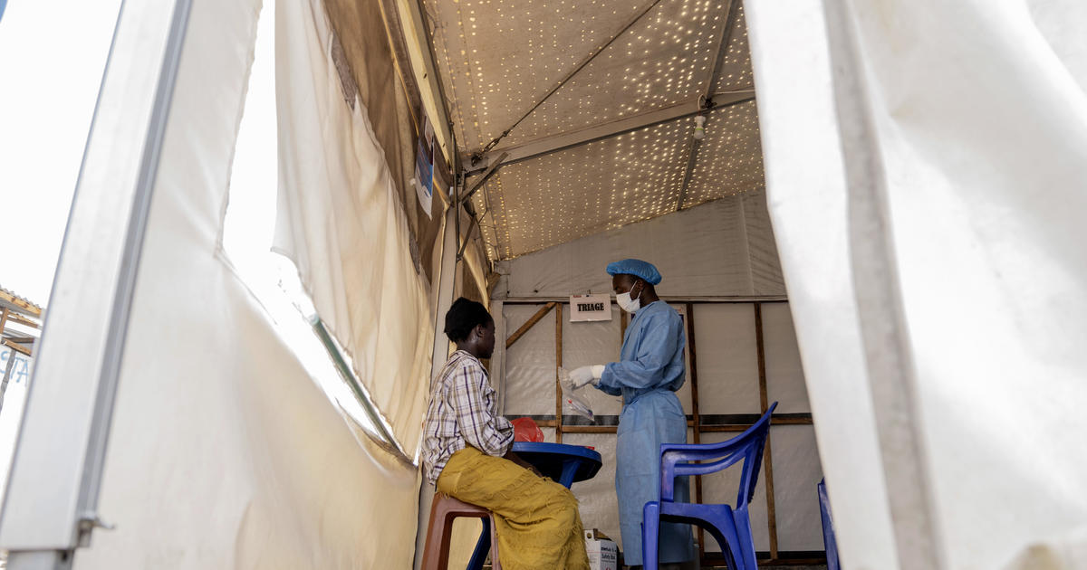 Mpox in the DRC: A Race Against Time