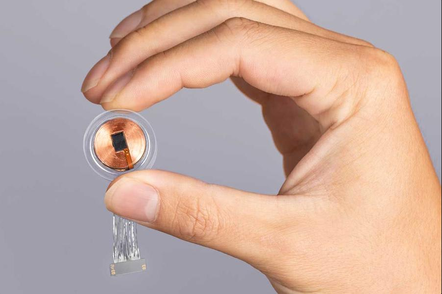 Neuralink Launches First UK Clinical Trial of Brain Chip, Building on US Success